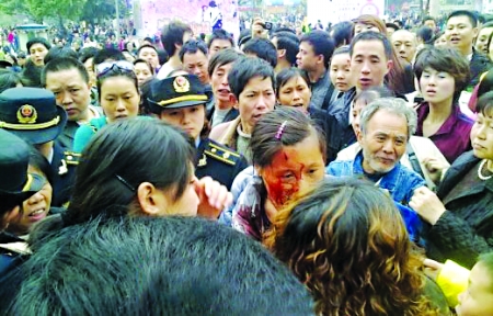 女城管“轻轻一挥”对讲机 小贩缝6针