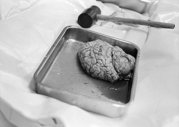 揭秘犯罪鉴证法医如何让死者“说话”