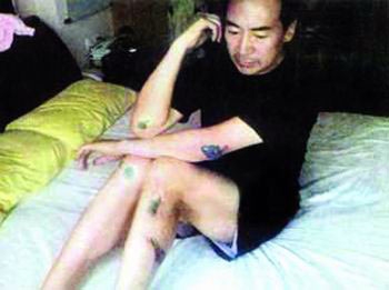 孙红雷小沈阳打架高峰斗欧 揭娱乐圈打人事件(图)