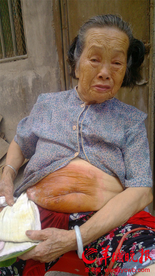 三儿数栋房拒赡养 79岁老人撤诉:不想他们坐牢