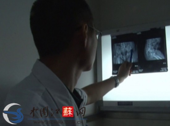 江苏淮安女婴体内取出4根缝衣针 或为人为扎入
