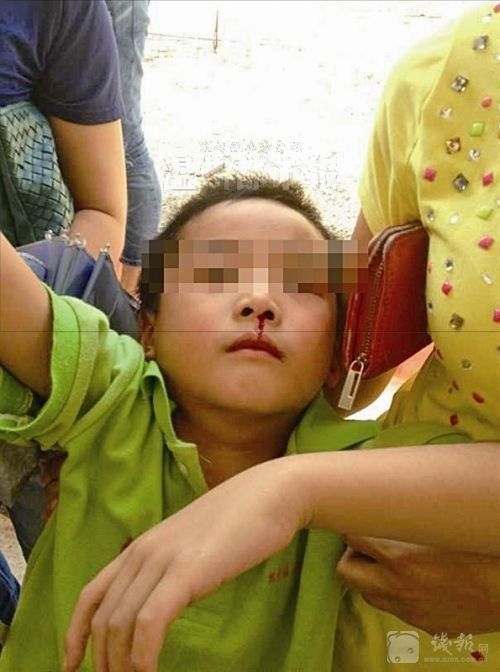 开学3天 浙江19名小学生疑因气体中毒流鼻血（图）