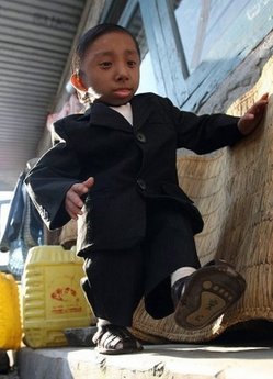 尼泊尔少年今成世界最矮人 梦想坐手袋周游世界