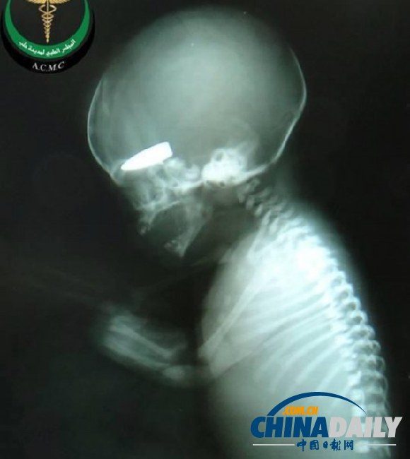 叙军拿孕妇当游戏标靶射死胎儿获香烟